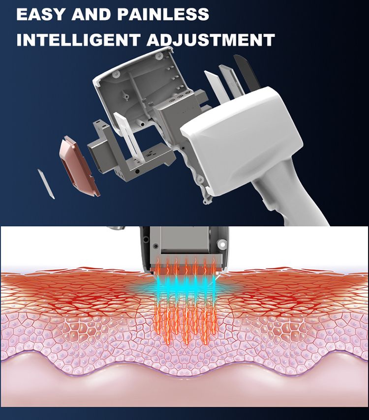 808nm hair removal device11